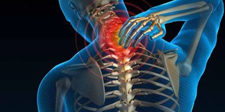 Cervical Spondylitis